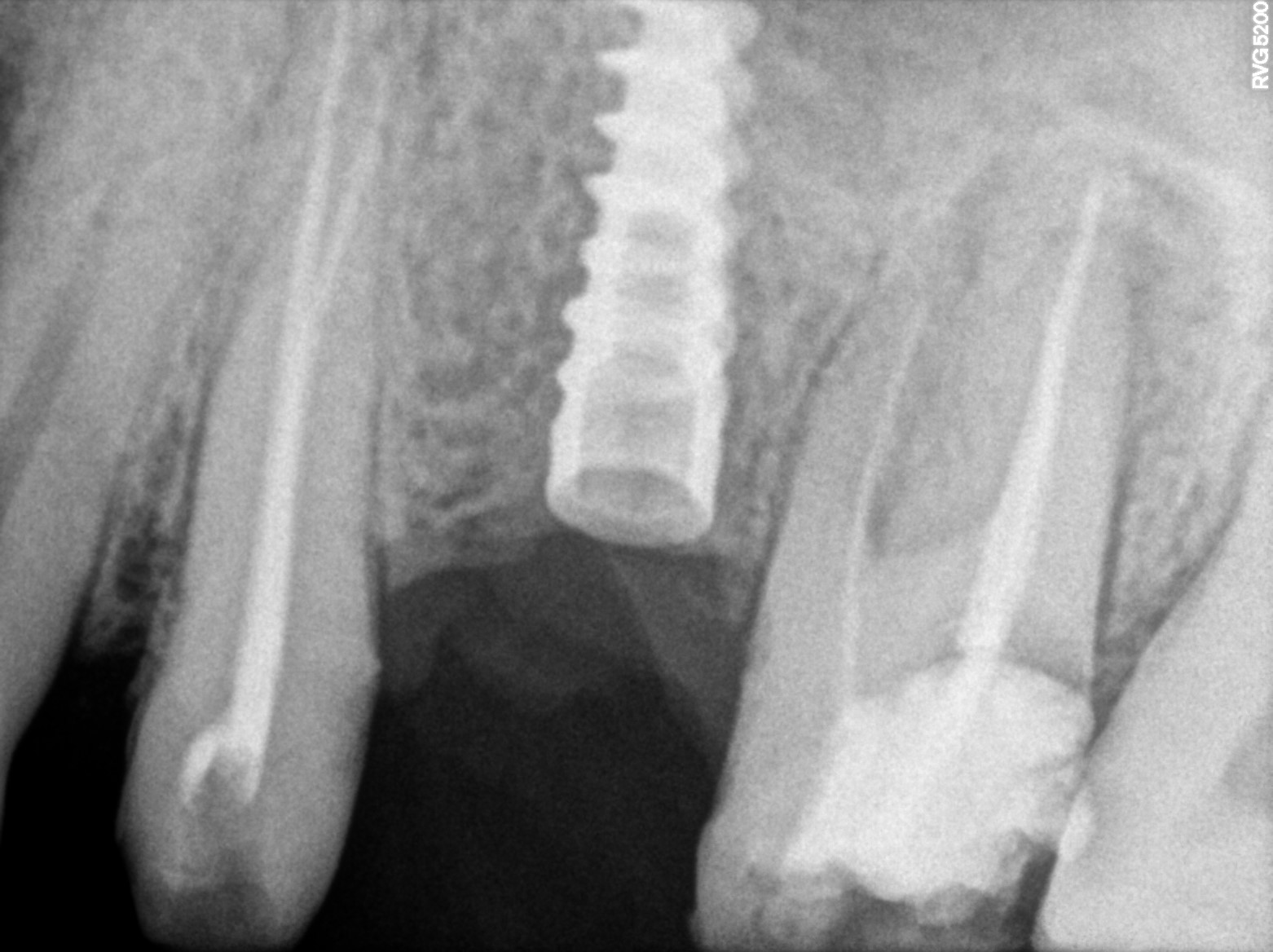 Dental X-ray